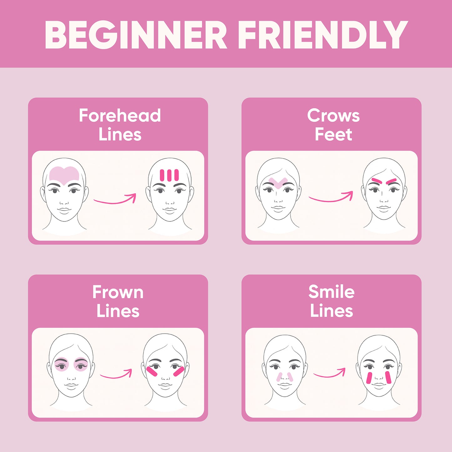 ZZSLEEP Face Tape — Overnight Anti-Wrinkle Patches for Forehead & Smile Lines, Infused with Collagen, Vitamin E & B, Aloe Vera Extract